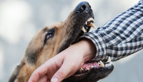 My Child Was Hurt in a Dog Attack, Should I Call Dog-Bite Lawyers in Minneapolis?